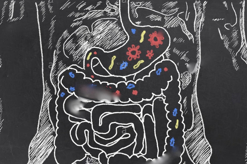 Intestinal Permeability, Gut Barrier Function  and Autoimmune disease